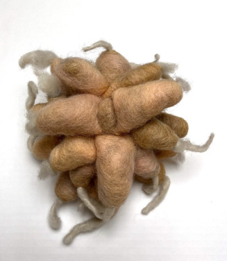 © Bildrecht, Wien, 2025; Foto: Artothek des Bundes